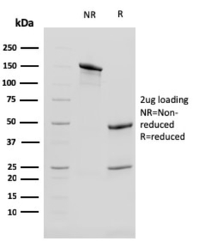 KRT13 Antibody