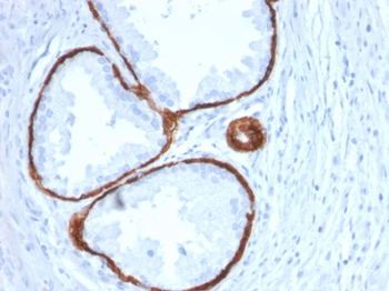 KRT14 Antibody