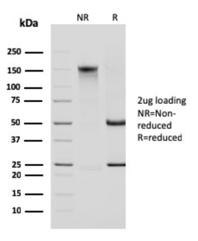 KRT14 Antibody