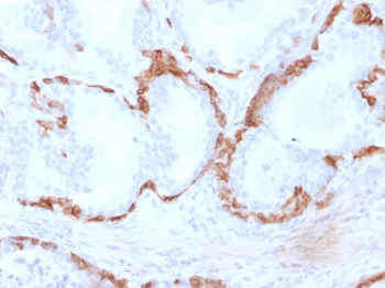 KRT14 Antibody