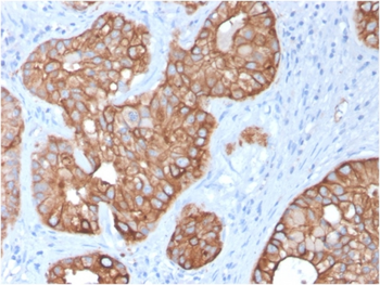 KRT15 Antibody