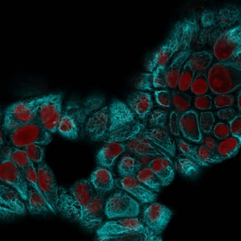 KRT15 Antibody