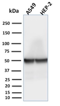 KRT18 Antibody
