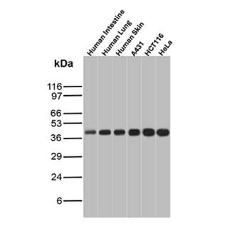 KRT18 Antibody