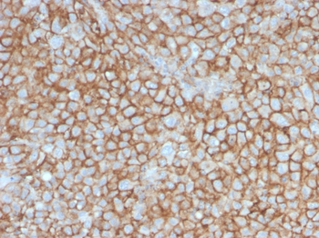 MCAM Antibody