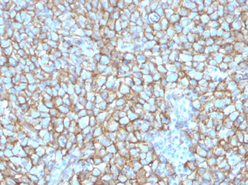 MCAM Antibody