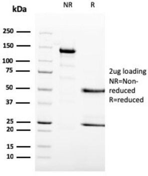 MCM6 Antibody