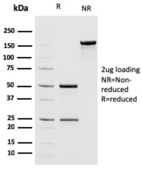 MSH2 Antibody