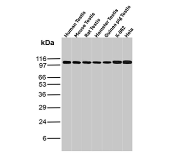 MSH2 Antibody