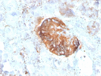 MTAP Antibody