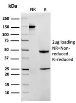 MTAP Antibody
