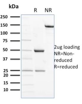 NCAM1 Antibody