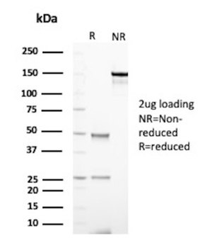 NGFR Antibody