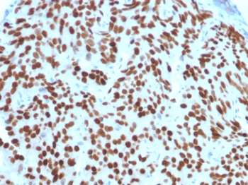 NKX3-1 Antibody