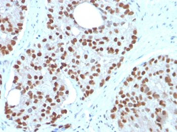 NKX3-1 Antibody