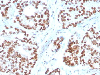 NKX3-1 Antibody