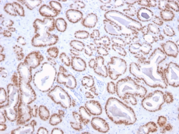 NKX3-1 Antibody