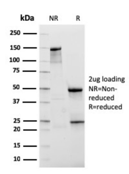 NKX3-1 Antibody