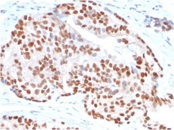 NKX3-1 Antibody