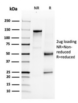 NKX3-1 Antibody