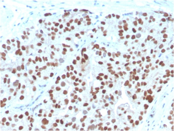 NKX3-1 Antibody
