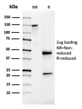 NKX3-1 Antibody