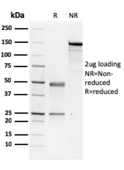 NME1 Antibody