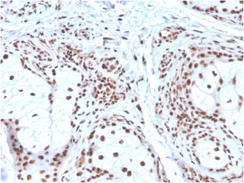 NPM1 Antibody