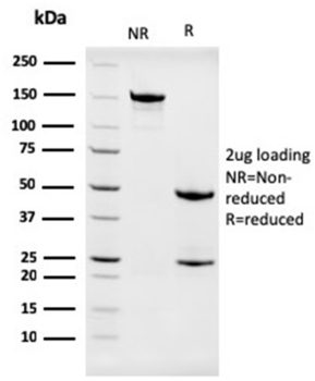 NPM1 Antibody