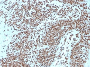 NPM1 Antibody