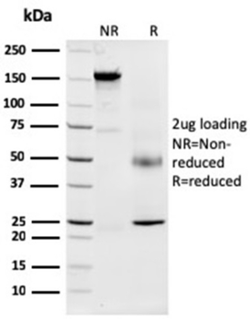 NPM1 Antibody