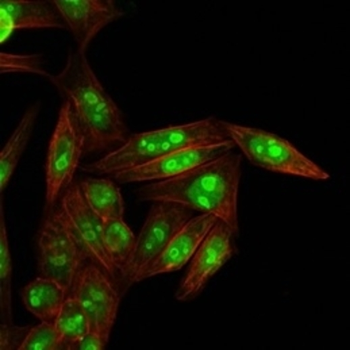 NPM1 Antibody