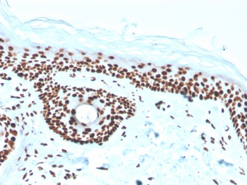 NPM1 Antibody