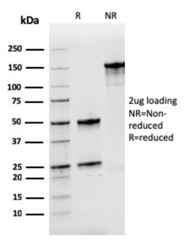 NPM1 Antibody