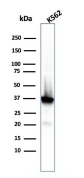 NPM1 Antibody
