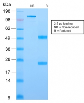 YBX1 Antibody