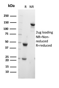 YBX1 Antibody