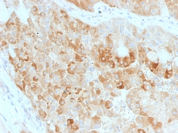 ROR2 Antibody