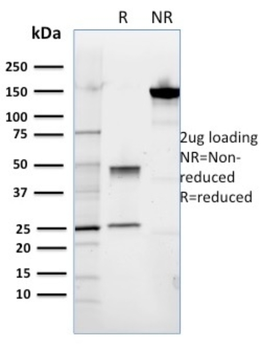 ROR2 Antibody