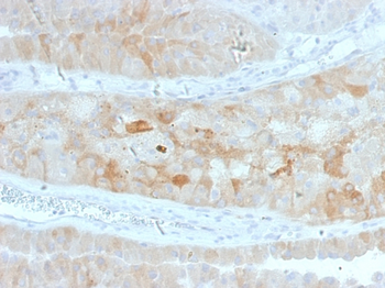 ROR2 Antibody
