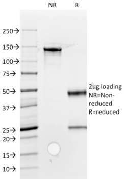ROR2 Antibody