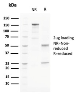 PAPPA Antibody