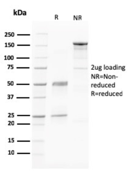 PAPPA Antibody