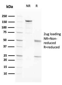 PAPPA Antibody