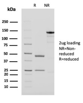 PAPPA Antibody