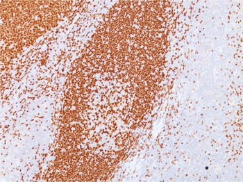 PAX5 Antibody
