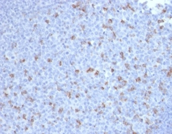 PDCD1 Antibody