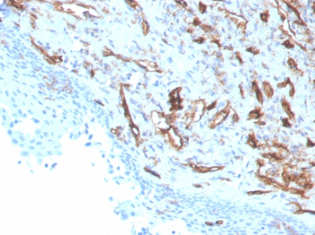 PECAM-1 Antibody