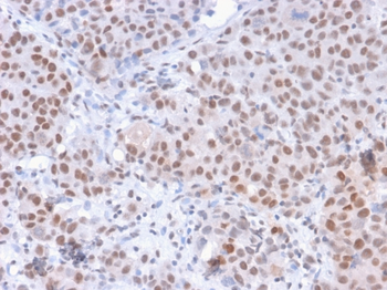 POLR2A Antibody