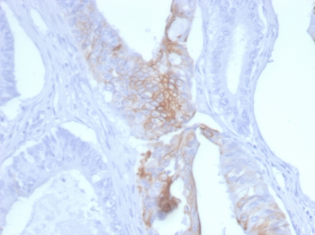 KRT20 Antibody